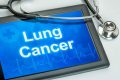 Lung-cancer screening